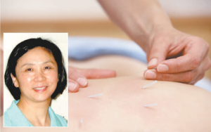 Acupuncture_web